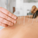 Apnea insomnia acupuncture westchester depression anxiety nausea